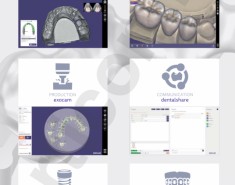 Программное обеспечение Exocad